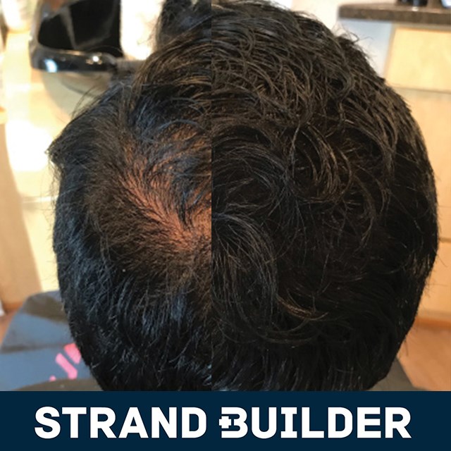 Strand Builder Hair Rejuvenation